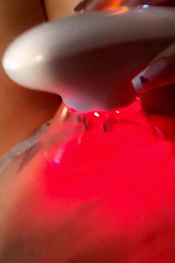 The Future Of Body Sculpting And Skin Tightening At Home: Redu Sculpt. 1 imgi 191 thumb 00001