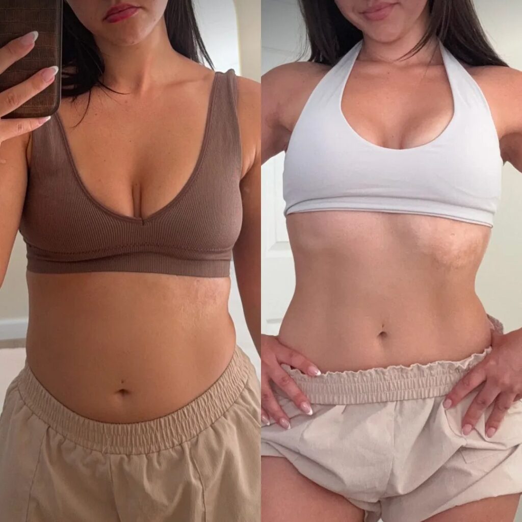 The Future Of Body Sculpting And Skin Tightening At Home: Redu Sculpt. 2 imgi 225 7cd19e1e 9684 4b1b 802f b4d32545a3dc