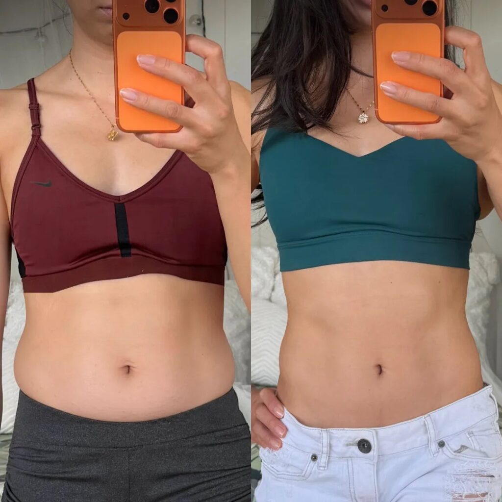 The Future Of Body Sculpting And Skin Tightening At Home: Redu Sculpt. 3 imgi 229 a8280870 f325 4fbd 8596 17380e7e48bd